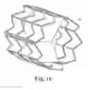 Fig. 06 - Delivery systems and methods of implantation for prosthetic heart valves