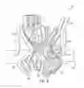 Fig. 07 - Prosthetic valve with sealing members and methods of use thereof