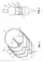 Fig. 02 - Prosthetic heart valve systems