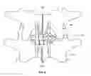 Fig. 07 - Interspinous Fusion Device and Method