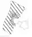 Fig. 01 - Acetabular prosthesis system