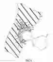 Fig. 05 - Acetabular prosthesis system