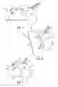 Fig. 06 - Acetabular prosthesis system