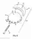 Fig. 08 - Acetabular prosthesis system