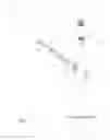 Fig. 02 - Durable resurfacing hip replacement device