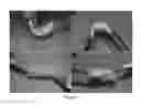 Fig. 06 - Engineered craniofacial constructs with composite scaffold