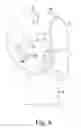 Fig. 07 - Eyewear Attachment System For A Helmet