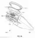 Fig. 02 - Infant head cradle with controlled head movement