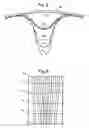 Fig. 08 - Jet nozzle mixer