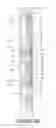 Fig. 03 - Multiple layer extrusion limiter