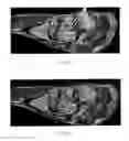 Fig. 06 - Method for three-dimensional turbo spin echo imaging