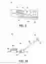 Fig. 07 - Non-compliant orthodontic system