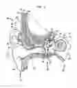 Fig. 02 - Hearing prosthesis having an on-board fitting system