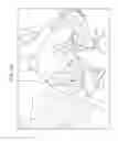Fig. 09 - Delivering pelvic floor repair implants