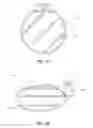 Fig. 02 - Flexible dam and retractor