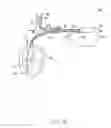 Fig. 04 - Implantable medical device configuration based on port usage