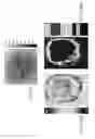 Fig. 22 - Compression device for enhancing normal/abnormal tissue contrast in MRI including devices and methods related thereto