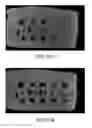 Fig. 32 - Compression device for enhancing normal/abnormal tissue contrast in MRI including devices and methods related thereto