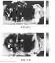 Fig. 33 - Compression device for enhancing normal/abnormal tissue contrast in MRI including devices and methods related thereto
