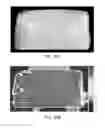 Fig. 41 - Compression device for enhancing normal/abnormal tissue contrast in MRI including devices and methods related thereto