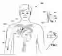 Fig. 02 - Determining inserted catheter end location and orientation