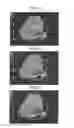 Fig. 09 - Method and apparatus for ultrasonic diagnosis