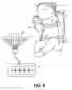 Fig. 04 - ECG leads system for newborn ECG screening