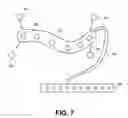 Fig. 05 - ECG leads system for newborn ECG screening