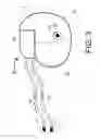 Fig. 04 - Implantable cardiac event detection device with an adaptive sleep state