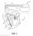 Fig. 02 - Method and apparatus for detecting and discriminating tachycardia