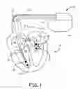 Fig. 02 - Method and apparatus for detecting and discriminating tachycardia