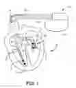 Fig. 02 - Method and apparatus for detecting and discriminating tachycardia