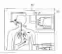 Fig. 01 - Measurement device and method for analyzing a sample gas by infrared absorption spectroscopy