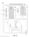 Fig. 30 - Minimally invasive determination of collateral ventilation in lungs