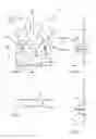 Fig. 02 - Stool collector