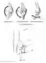 Fig. 02 - Method and system for knee joint evaluation and diagnostic aid in normal and pathologic state