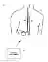 Fig. 01 - Detecting posture sensor signal shift or drift in medical devices