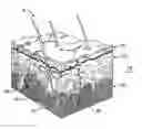 Fig. 01 - METHOD AND SYSTEM FOR TREATING SKIN TISSUE