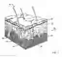 Fig. 02 - METHOD AND SYSTEM FOR TREATING SKIN TISSUE
