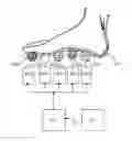 Fig. 01 - METHOD AND DEVICE FOR LESSENING THE EFFECTS OF BENIGN PROSTATIC HYPERPLASIA