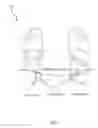 Fig. 02 - METHOD AND DEVICE FOR LESSENING THE EFFECTS OF BENIGN PROSTATIC HYPERPLASIA