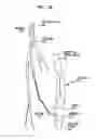 Fig. 07 - Percutaneous collateral bypass