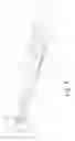 Fig. 09 - Medicine dispensing device