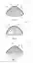 Fig. 03 - COMPOSITIONS FOR TREATMENT AND USE OF A PALATAL PATCH