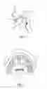 Fig. 05 - COMPOSITIONS FOR TREATMENT AND USE OF A PALATAL PATCH