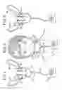 Fig. 02 - Oral mouthpiece and method for the use thereof