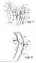 Fig. 06 - Steerable Medical Device Having Means For Imparting Multiple Curves in the Device