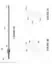 Fig. 07 - Reperfusion balloon inflation device