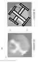 Fig. 07 - Catheter system having a fluid circuit