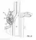 Fig. 19 - Heat exchanger for high flow rate infusion